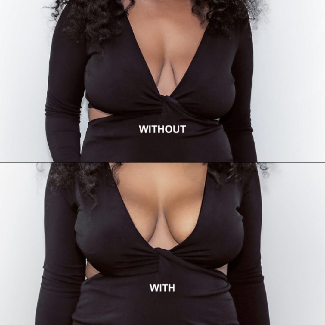 Confident Curves Lift